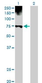 PGM1 Antibody in Western Blot (WB)