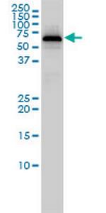 PGM1 Antibody in Western Blot (WB)