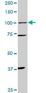 PGR Antibody in Western Blot (WB)