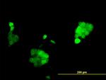 PGR Antibody in Immunocytochemistry (ICC/IF)