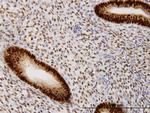 PGR Antibody in Immunohistochemistry (Paraffin) (IHC (P))