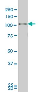 PGR Antibody in Western Blot (WB)