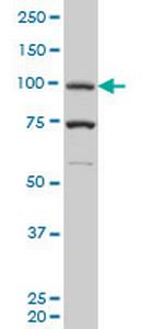 PGR Antibody in Western Blot (WB)