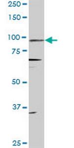 PGR Antibody in Western Blot (WB)