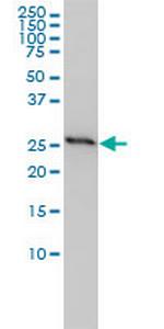 PHB Antibody in Western Blot (WB)