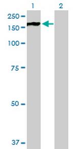 PHKA2 Antibody in Western Blot (WB)