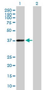 PHYH Antibody in Western Blot (WB)