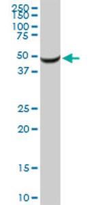 SERPINA1 Antibody in Western Blot (WB)