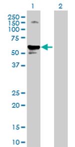 SERPINA1 Antibody in Western Blot (WB)