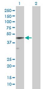 SERPINE2 Antibody in Western Blot (WB)