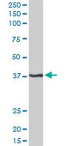 PITX1 Antibody in Western Blot (WB)