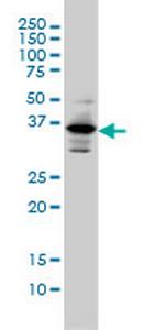 PITX1 Antibody in Western Blot (WB)