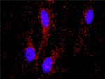 PITX2 Antibody in Proximity Ligation Assay (PLA) (PLA)