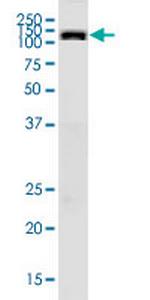 PKD2 Antibody in Western Blot (WB)