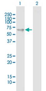 PKLR Antibody in Western Blot (WB)