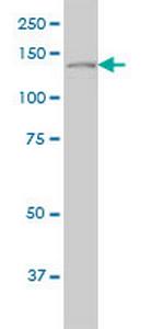 PLCG1 Antibody in Western Blot (WB)