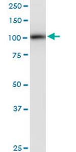 PLD2 Antibody in Western Blot (WB)