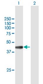 PLEK Antibody in Western Blot (WB)