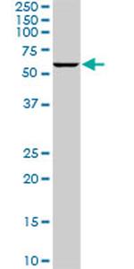 PLK1 Antibody in Western Blot (WB)