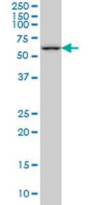 PLK1 Antibody in Western Blot (WB)