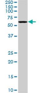 PLK1 Antibody in Western Blot (WB)