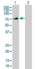 PLTP Antibody in Western Blot (WB)