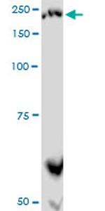 PLXNA2 Antibody in Western Blot (WB)