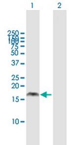 PMAIP1 Antibody in Western Blot (WB)