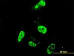 PML Antibody in Immunocytochemistry (ICC/IF)