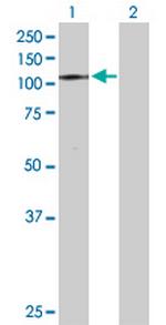 PMS2 Antibody in Western Blot (WB)