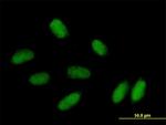 PRRX1 Antibody in Immunocytochemistry (ICC/IF)