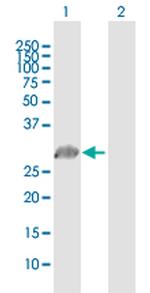 PRRX1 Antibody in Western Blot (WB)