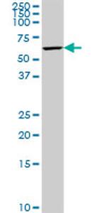 PNLIPRP2 Antibody in Western Blot (WB)