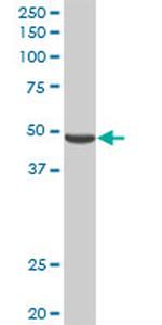 PNLIPRP2 Antibody in Western Blot (WB)