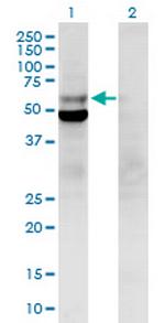 POLD2 Antibody in Western Blot (WB)