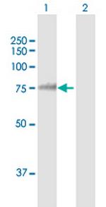 POR Antibody in Western Blot (WB)