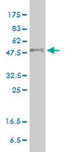 PPARD Antibody in Western Blot (WB)