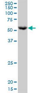 PPAT Antibody in Western Blot (WB)