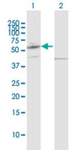 PPAT Antibody in Western Blot (WB)