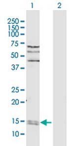 PPIA Antibody in Western Blot (WB)