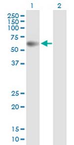 PPM1B Antibody in Western Blot (WB)