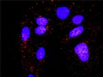 PPM1B Antibody in Proximity Ligation Assay (PLA) (PLA)