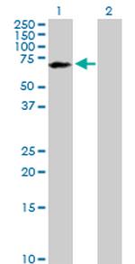 PPM1B Antibody in Western Blot (WB)