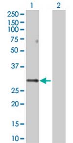 PPP1R2 Antibody in Western Blot (WB)