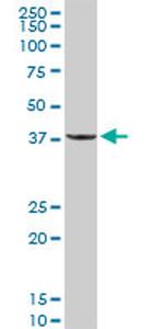 PPP1R3C Antibody in Western Blot (WB)