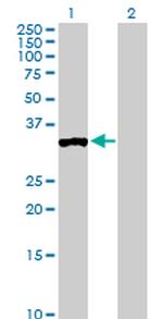 PPP1R3C Antibody in Western Blot (WB)