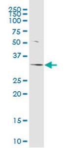 PPP1R3C Antibody in Western Blot (WB)