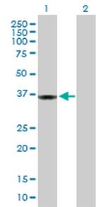 PPP1R3C Antibody in Western Blot (WB)