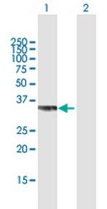 PPP2CB Antibody in Western Blot (WB)