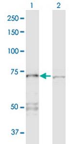 PPP2R1A Antibody in Western Blot (WB)